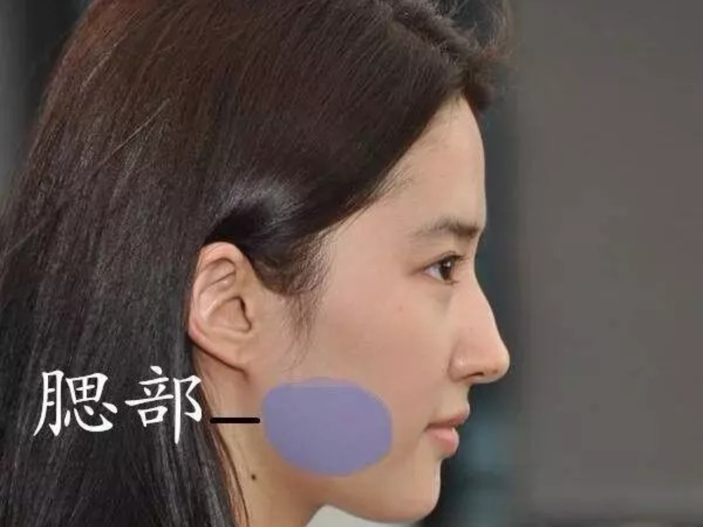 磨腮削骨#发腮发腮