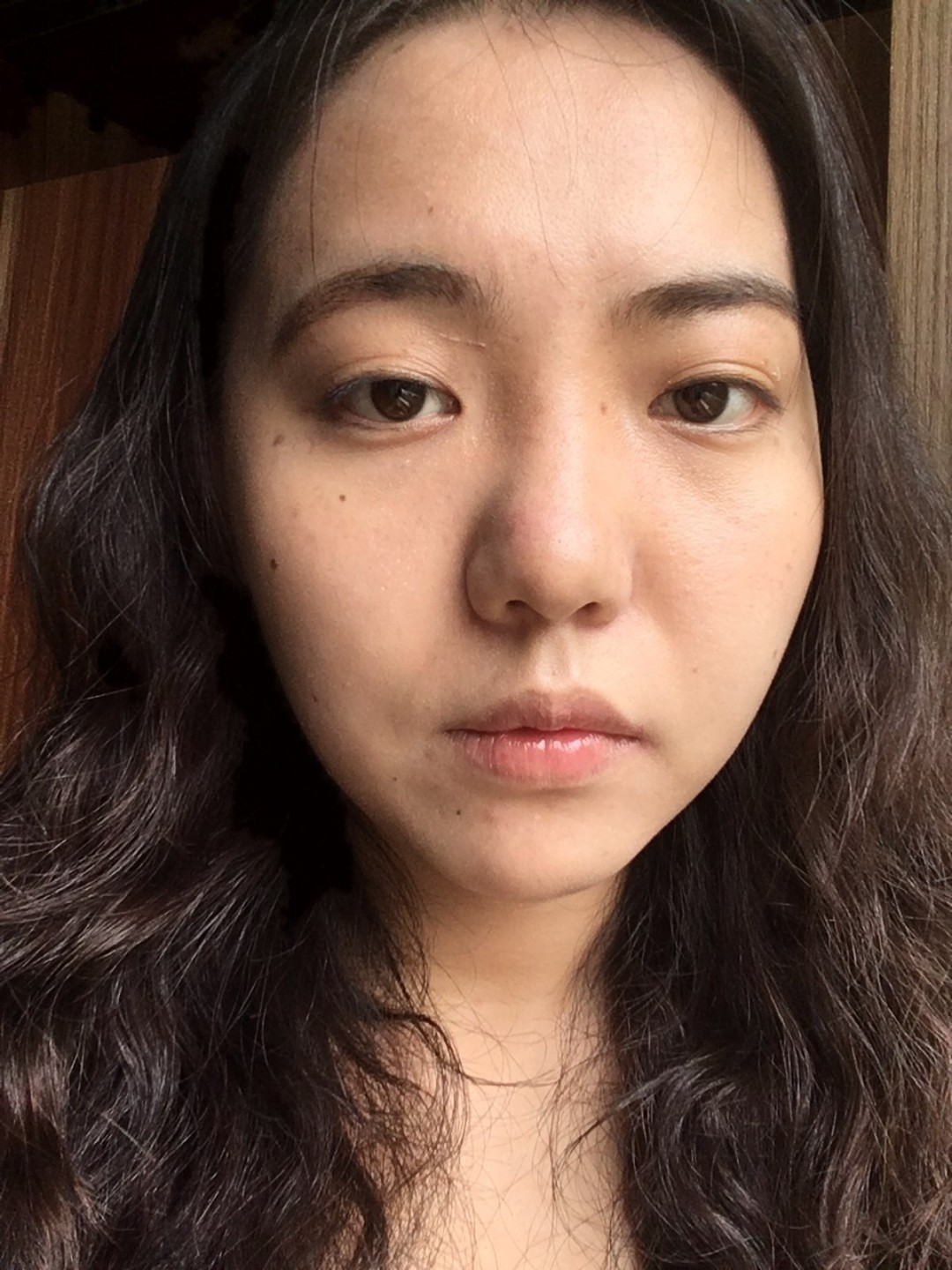 我的鼻子很差,非常的不好看,鼻子塌没有鼻根,鼻头大_圈子-新氧美容