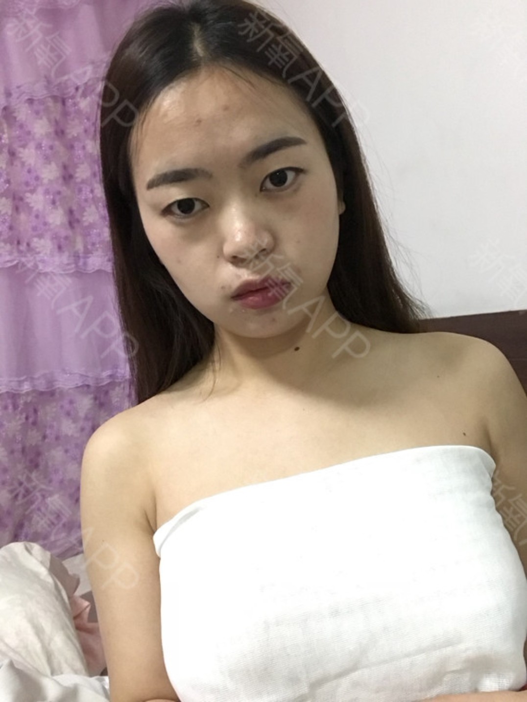 我胸部很小但_圈子-新氧美容整形