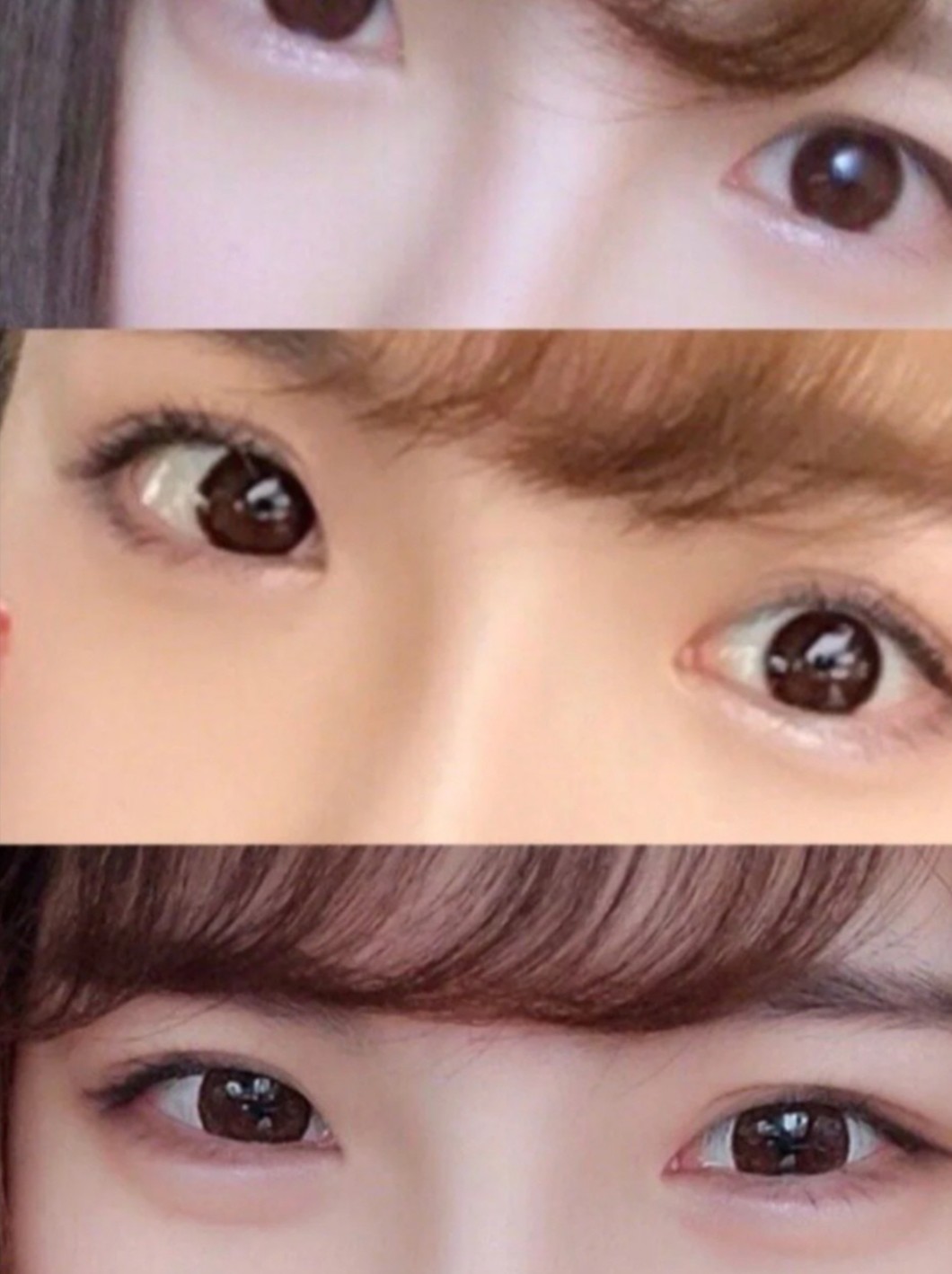 玻尿酸丰卧蚕 达到放大眼睛的惊人效果