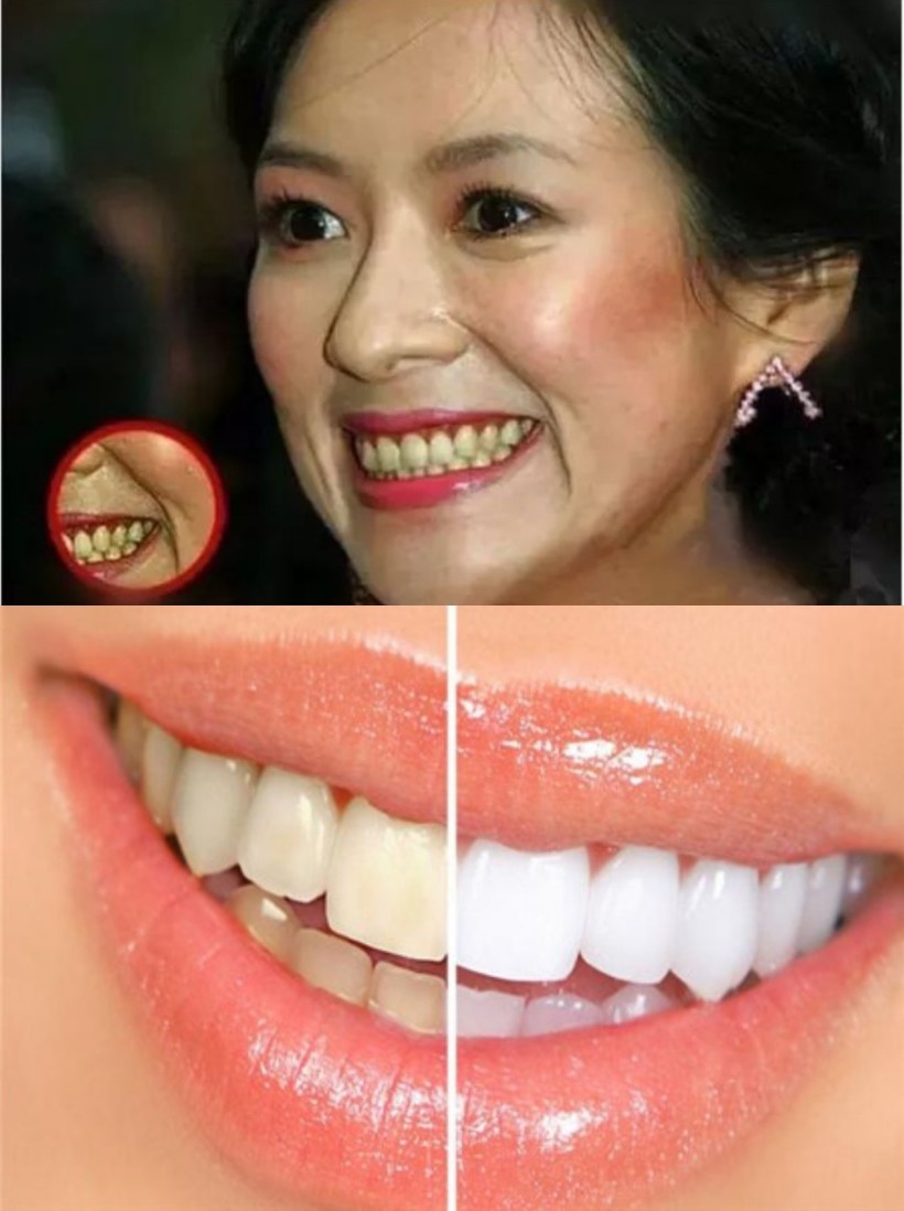 牙齿在脸上虽然不是五官这么外显存在,但它却和五官一样可以影响一个