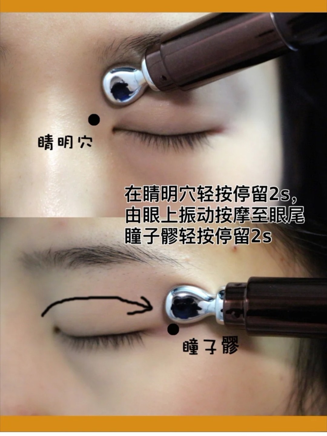 「去眼袋大法中医穴位按摩」