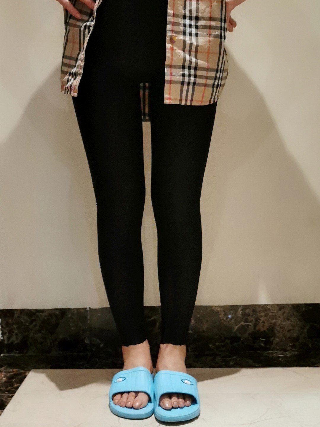 手术项目:#大小腿吸脂 瘦腿针 黄金射频