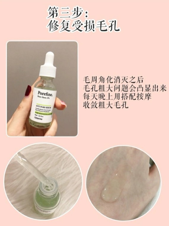 鸡皮疙瘩皮肤粗糙闭口(脸部皮肤很粗糙,全是小鸡皮疙瘩) 鸡皮疙瘩皮肤粗糙闭口(脸部皮肤很粗糙,全是小鸡皮疙瘩)