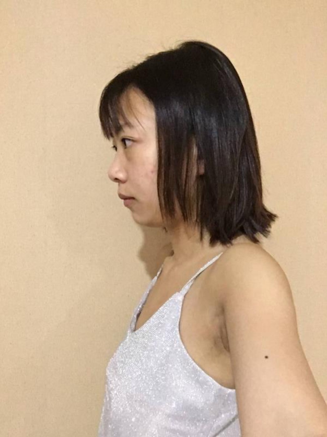 已经平胸20多年了,之前一_圈子-新氧美容整形