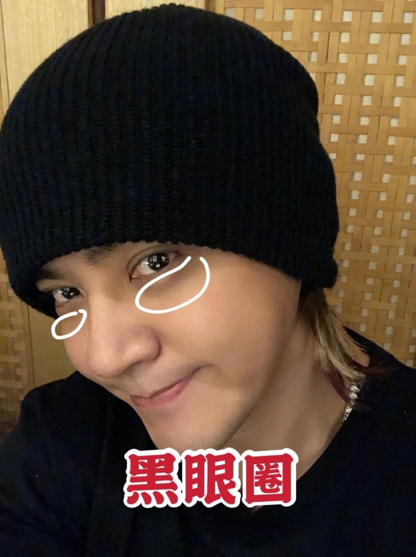 黄子韬教你分清卧蚕和黑眼圈!
