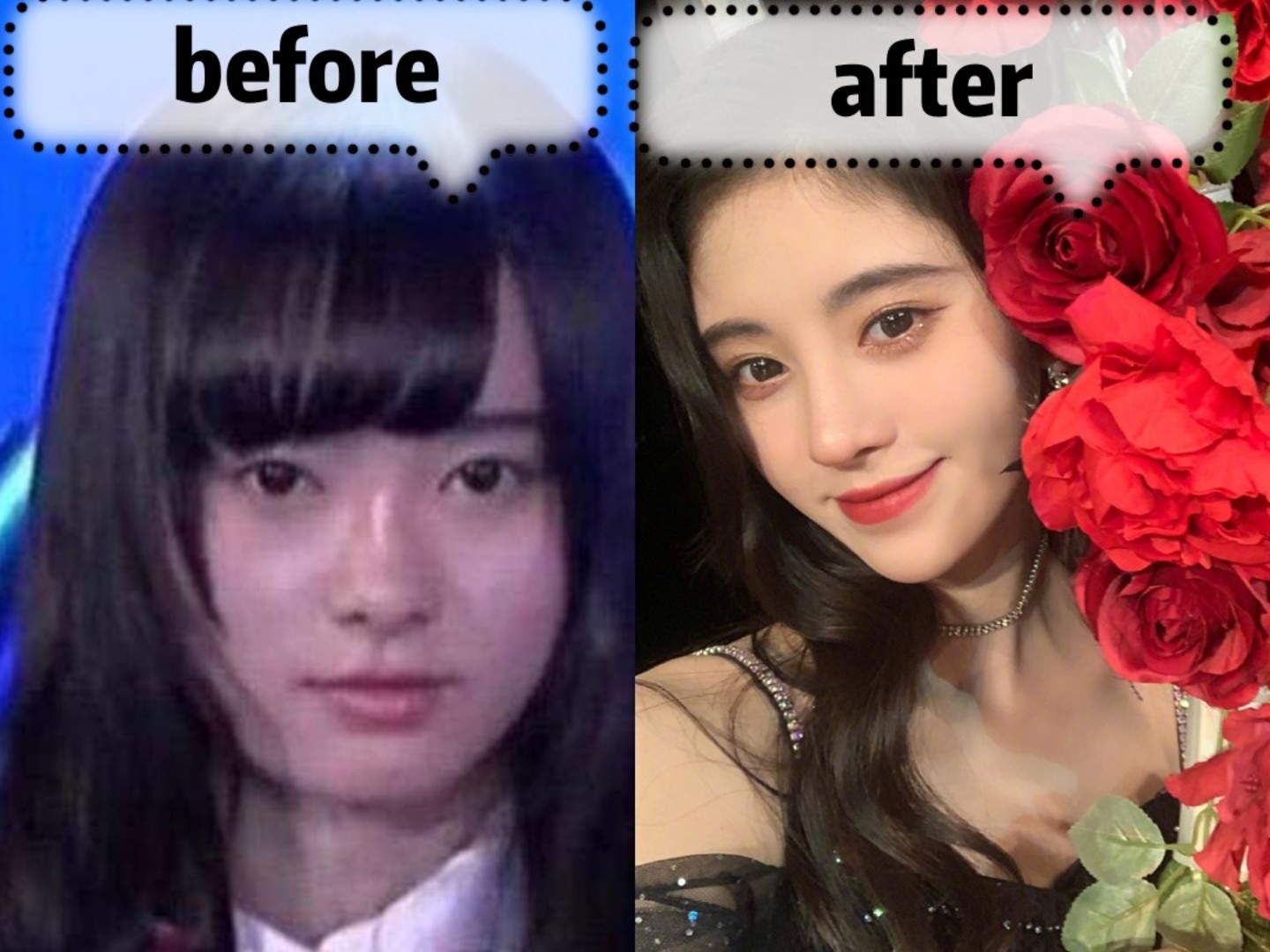 可以说下巴直接决定着脸型美丑,从风靡一时的锥子脸到现在很多人大热