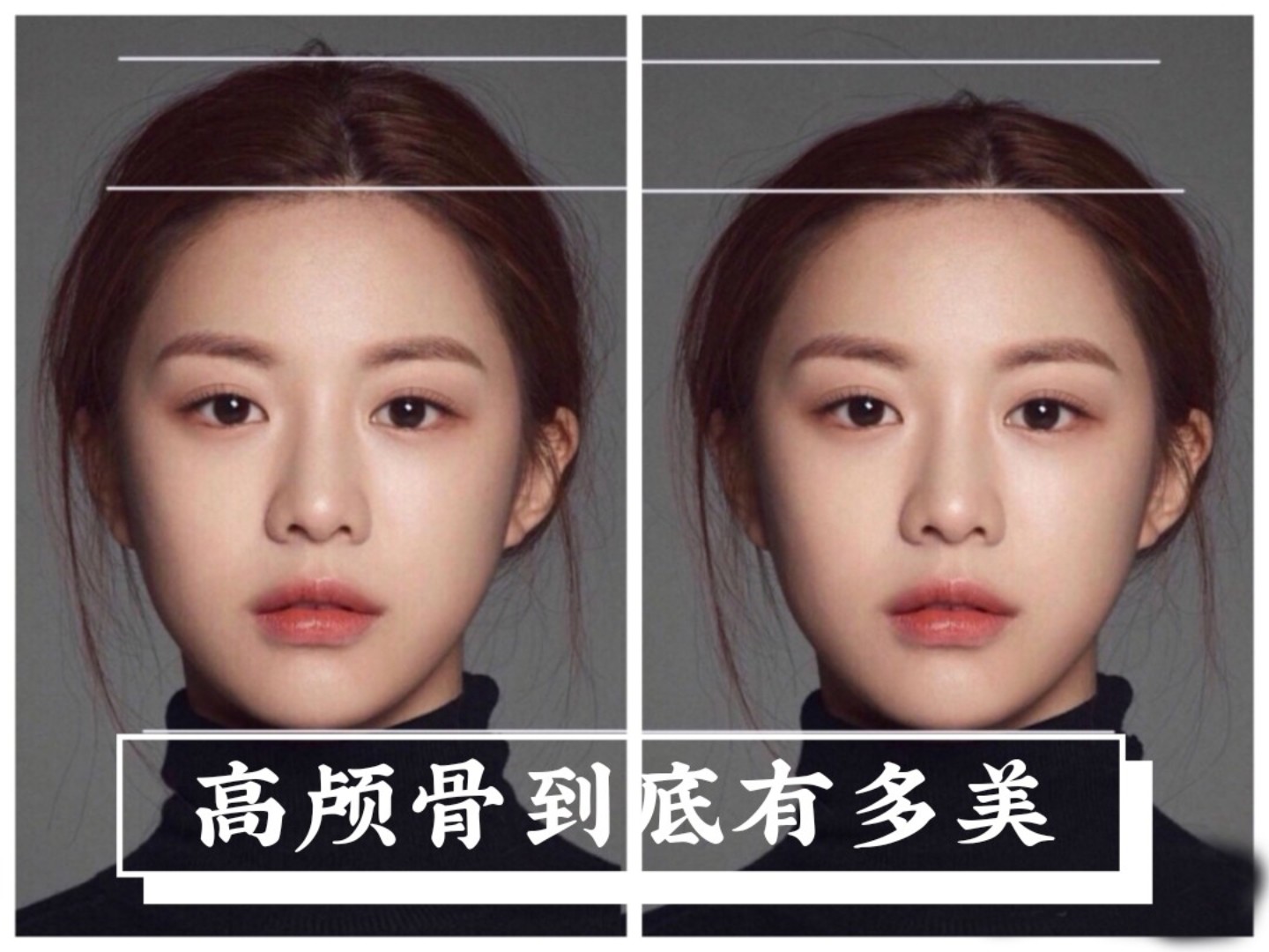 近两年流行的高颅顶审美.