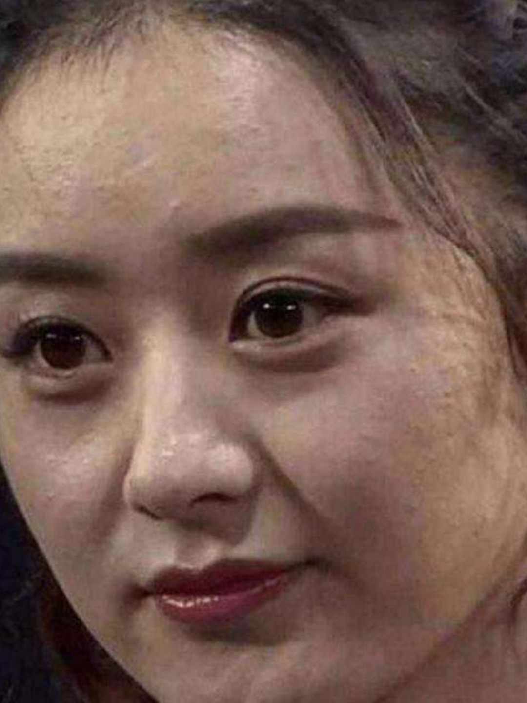 面部出油多,黑头问题就随之而来了.