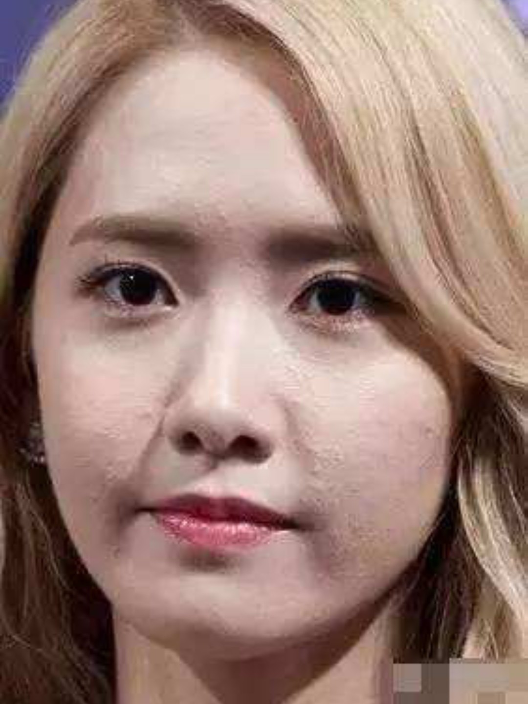 面部出油多,黑头问题就随之而来了.