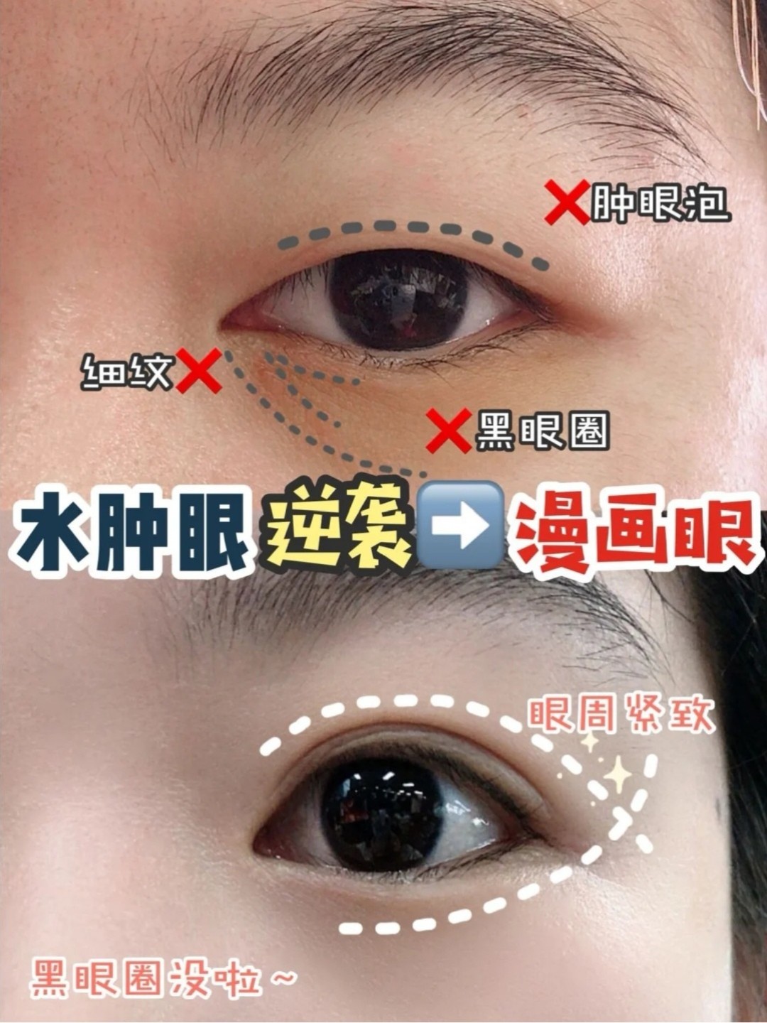 肿眼泡内双的妹子一定要看完#肿眼泡
