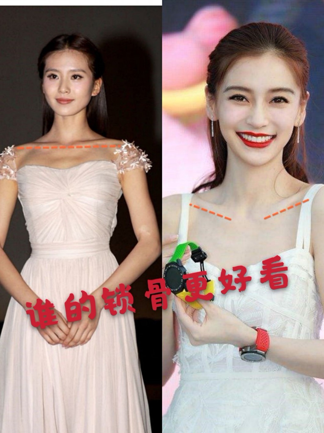从锁骨的形态来划分,锁骨可以分为两个类型