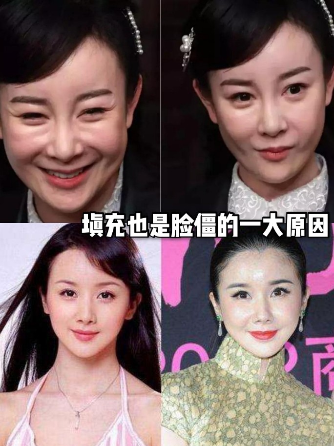 为什么女明星抗衰会脸僵?她们都do了啥?