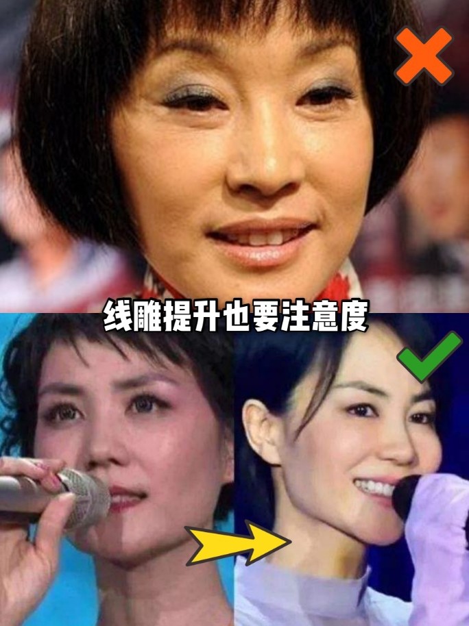 為什麼女明星抗衰會臉僵?她們都do了啥?