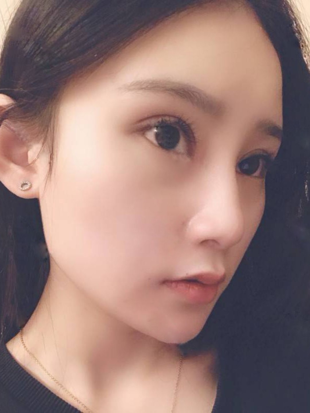 最近嘴角都是向上翘的,主要还是因为眼睛恢复的好看,_圈子-新氧美容