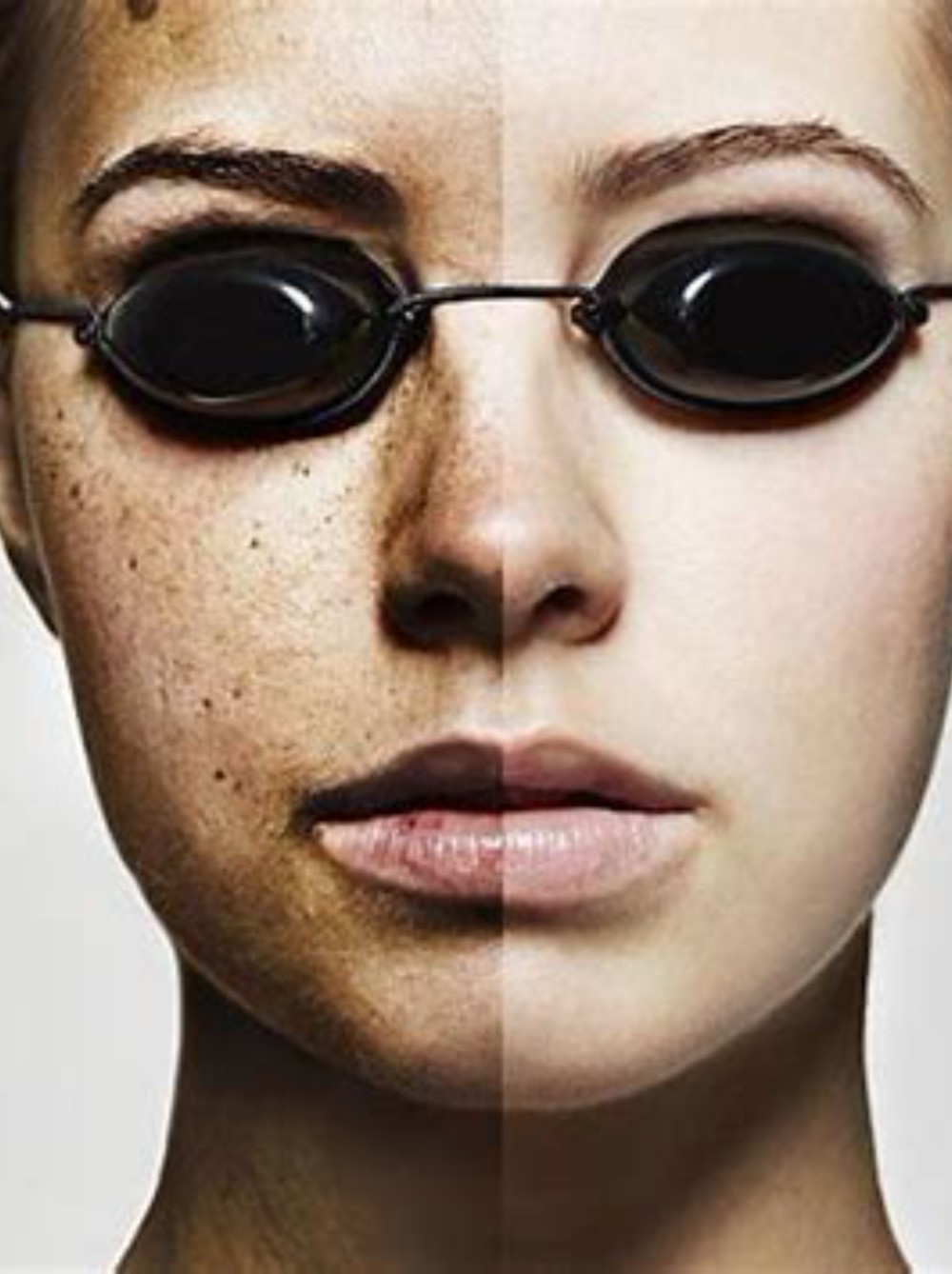 亦敌亦友的紫外线(1)为什么紫外线照射会使我们变黑?