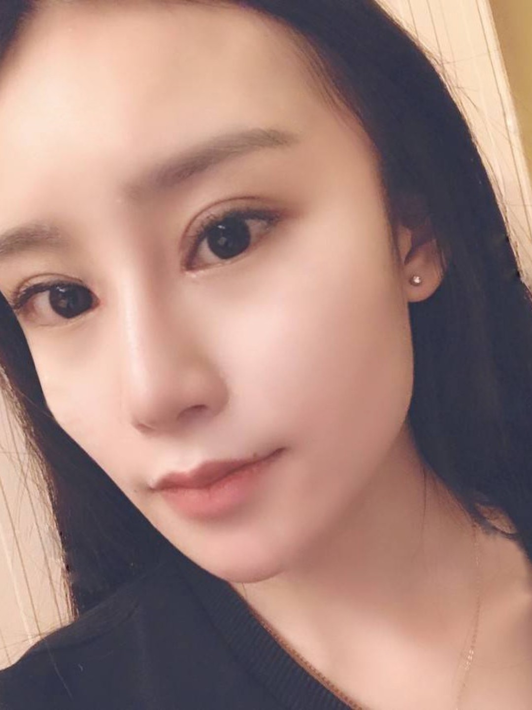 最近嘴角都是向上翘的,主要还是因为眼睛恢复的好看,_圈子-新氧美容