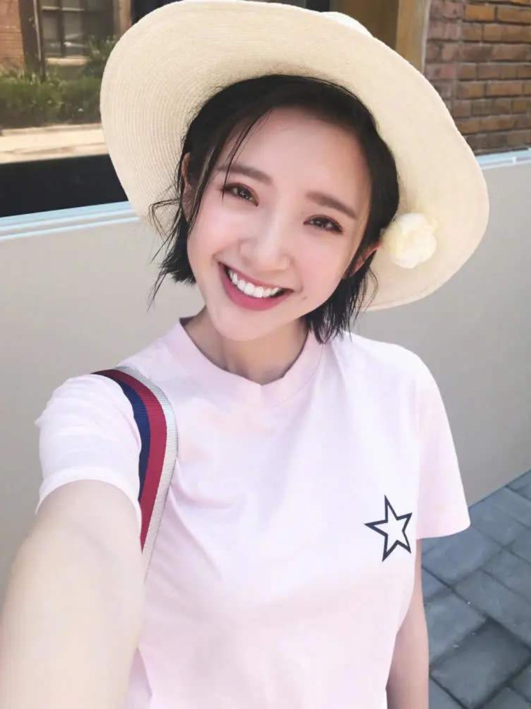 94拥有一口白牙是非常重要的,一口白牙能提高你的颜值_圈子-新氧