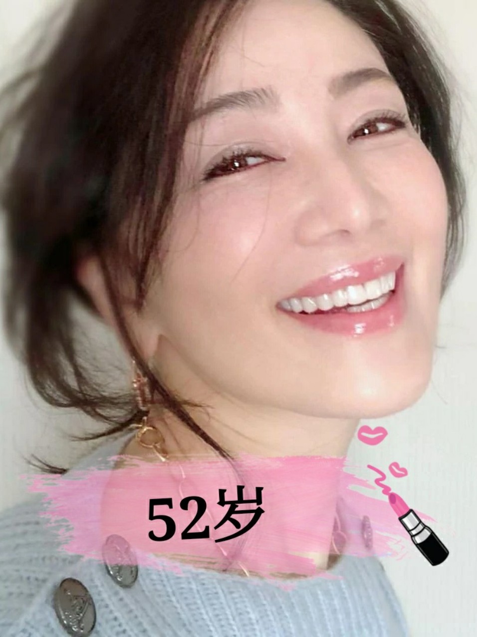 冠军坂_圈子-新氧美容整形
