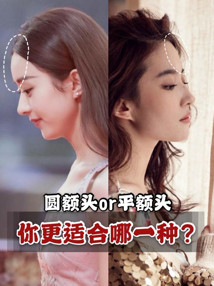 7215自测:你适合哪种形状的额头?集美们!