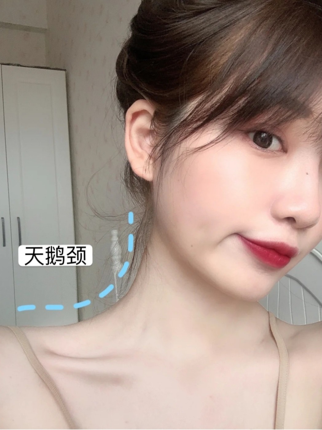 轻松get少女直角肩天鹅颈天鹅颈直_圈子-新氧美容整形
