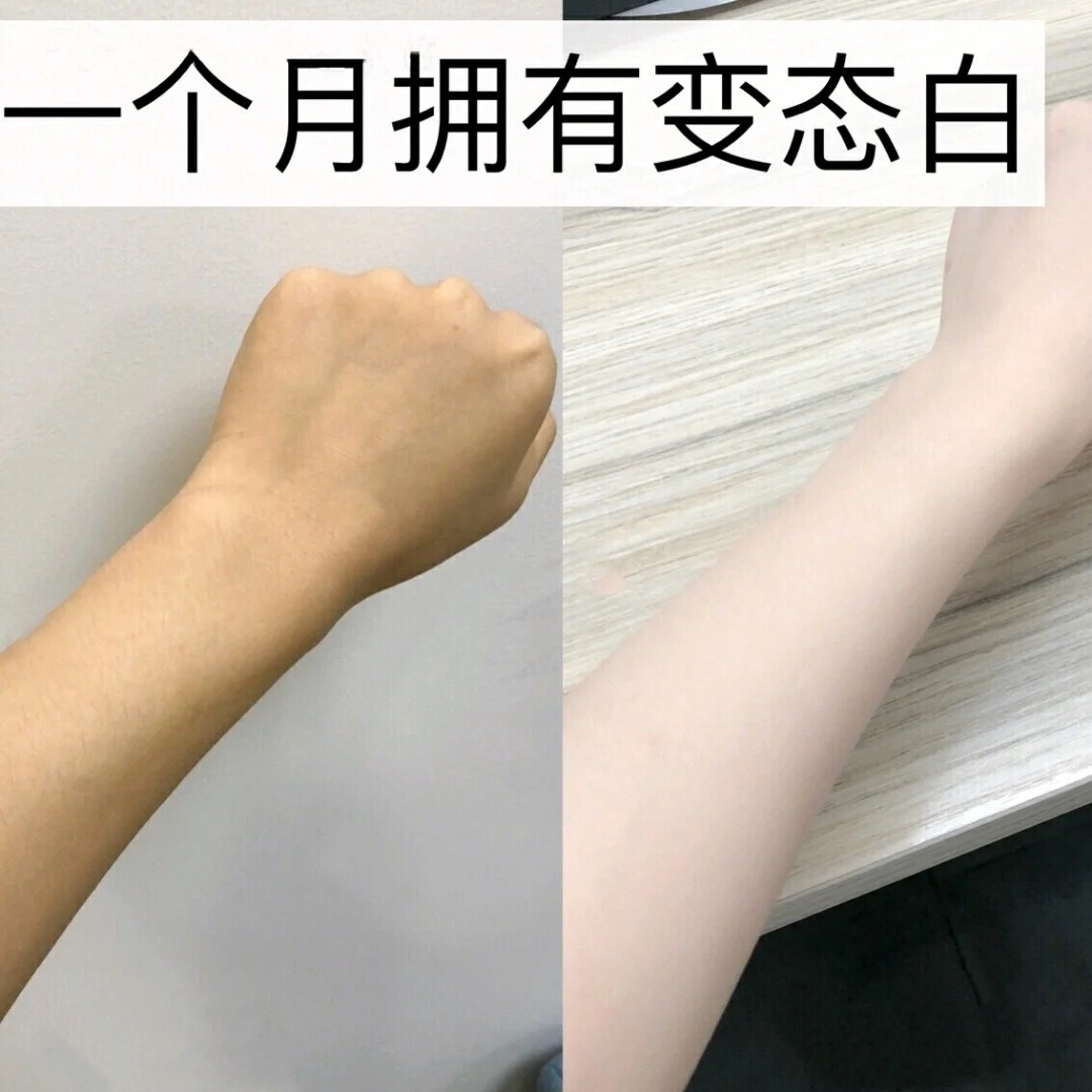 天生黑也不怕 美白针 我是熬夜非常厉害的 因为 圈子 新氧美容整形