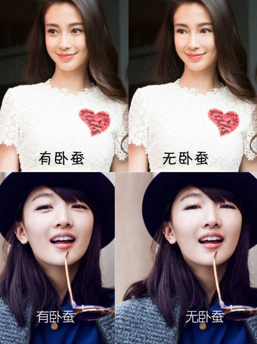 说道黄子韬,不得不提的就是他脸上那标志性的大卧蚕.