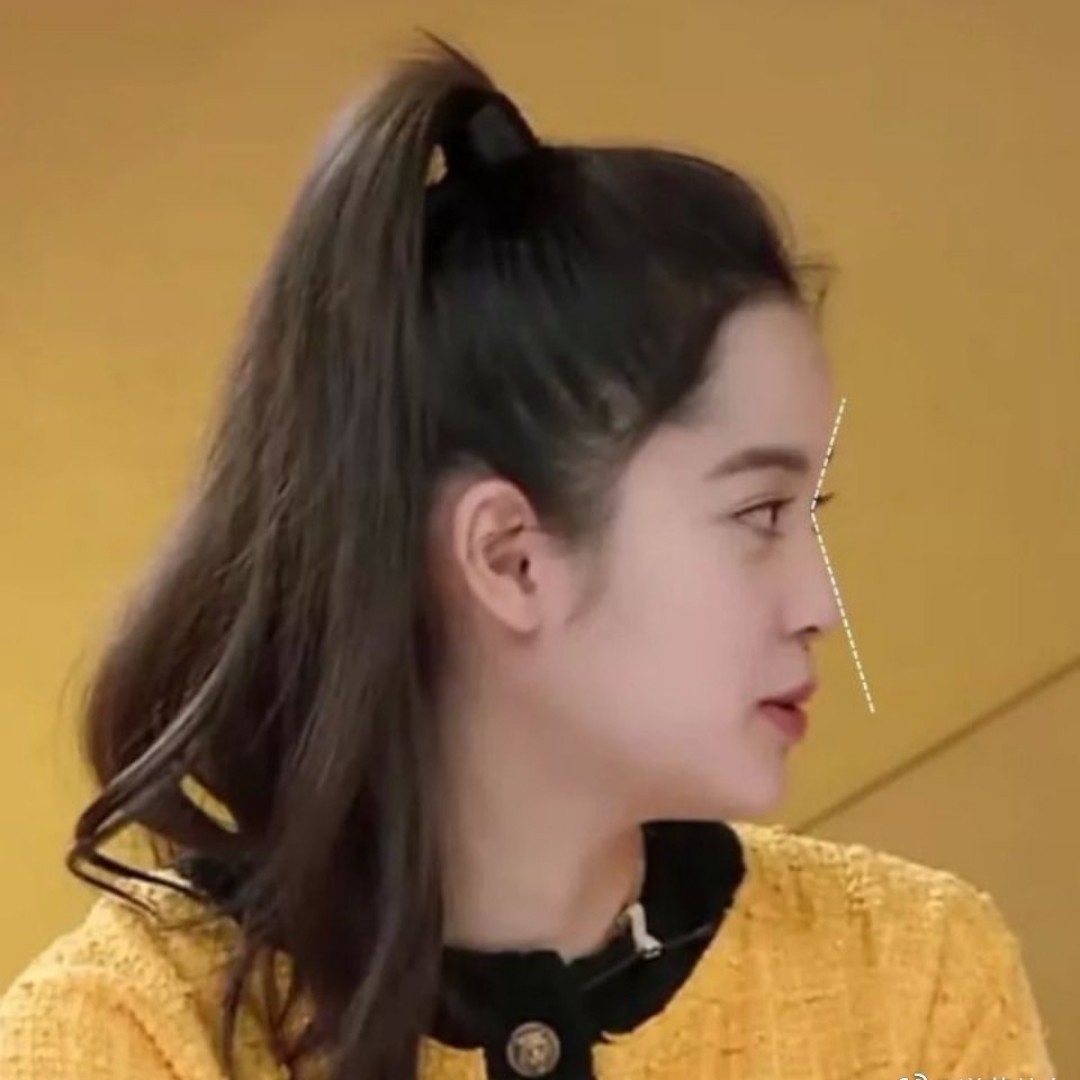 好看的鼻额角究竟是怎么样的?