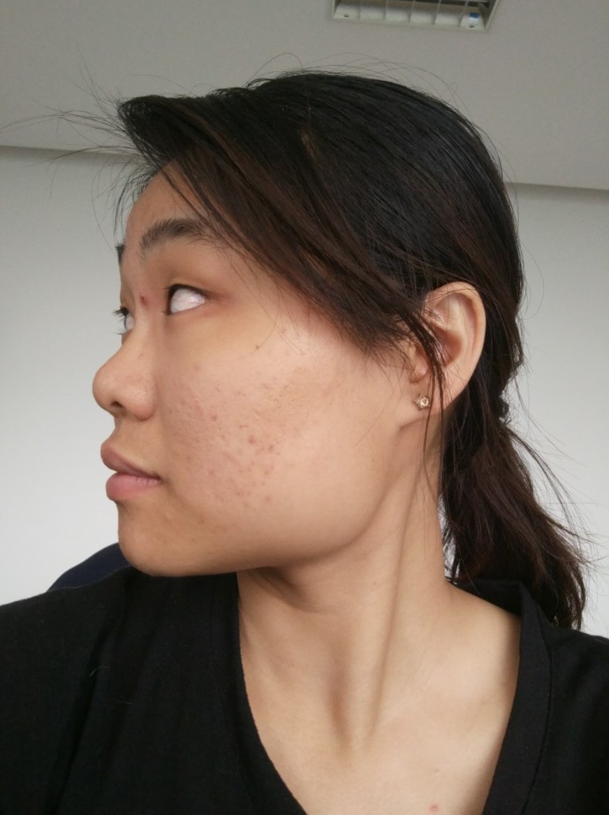 脸又方又大伤不起.﹏.