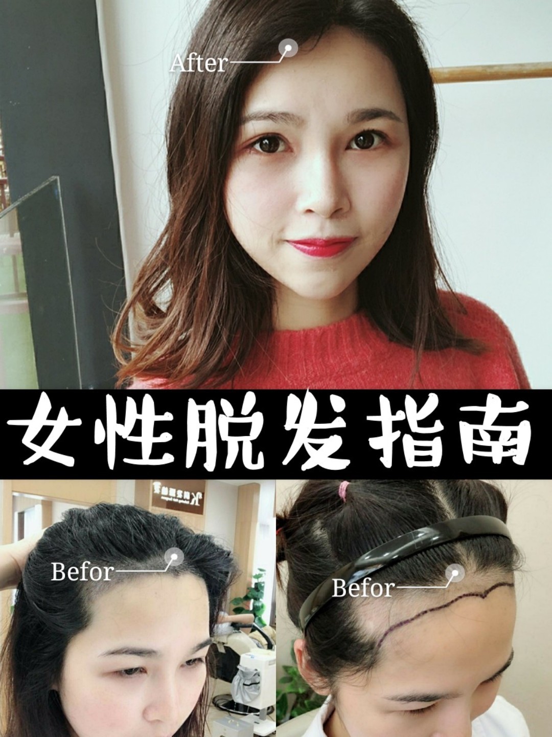 針對女生脫髮問題解決指南