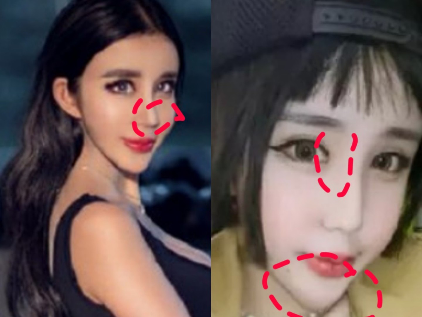 花季少女终成蛇精脸李蒽熙是一个被骂和整容而火起来的_圈子-新氧美容