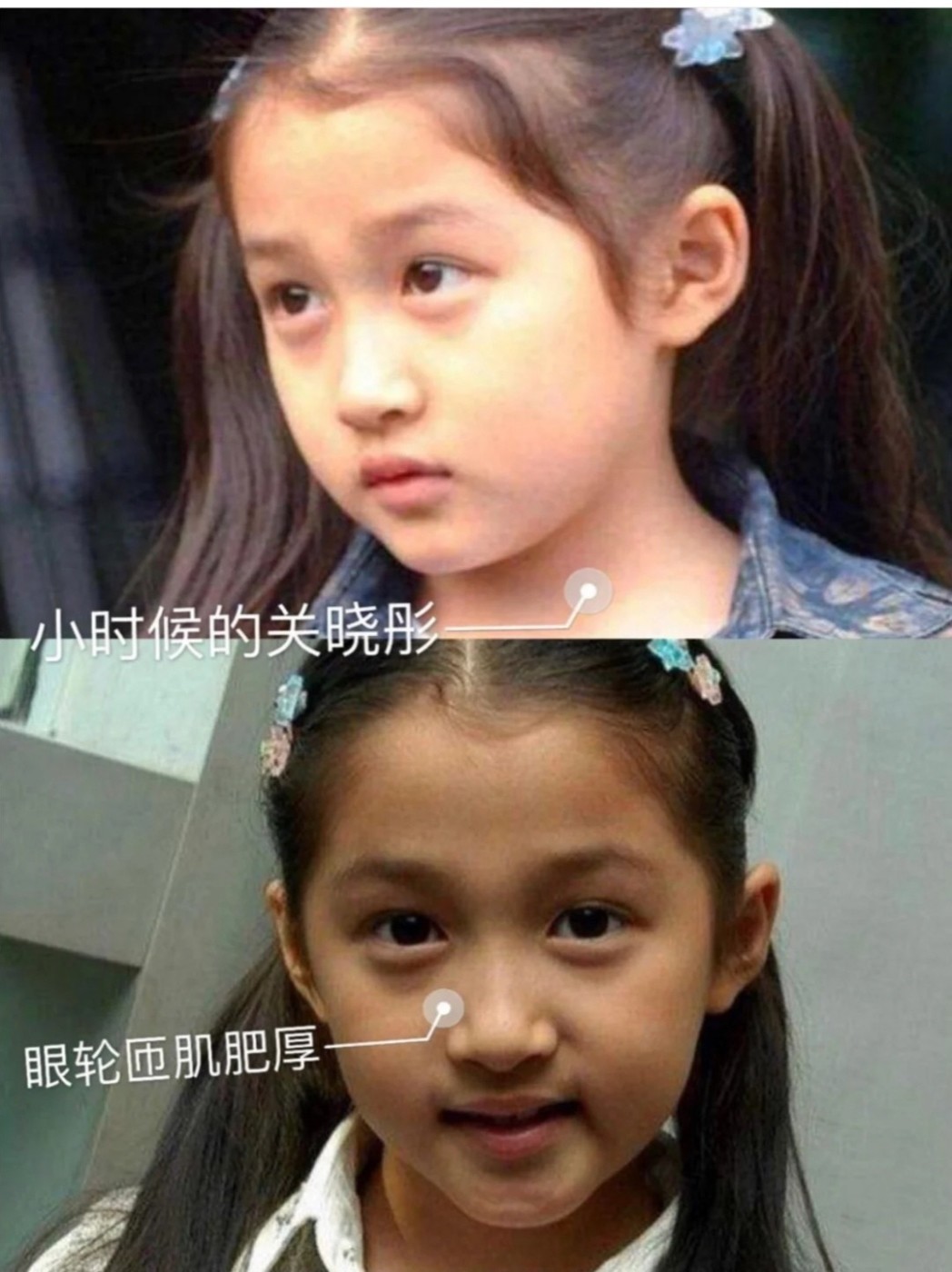关晓彤作为97年的"_圈子-新氧美容整形