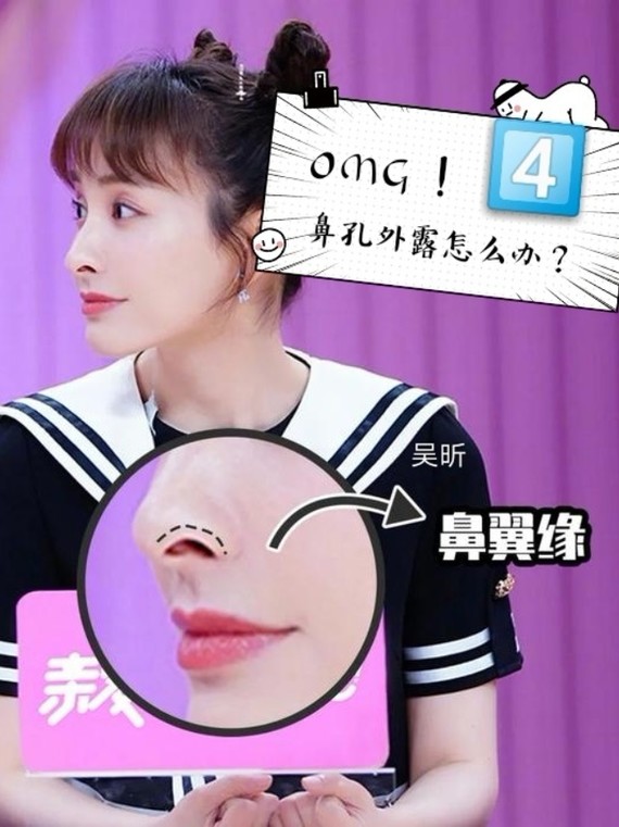 93你知道什么是鼻翼缘缺损矫正吗?