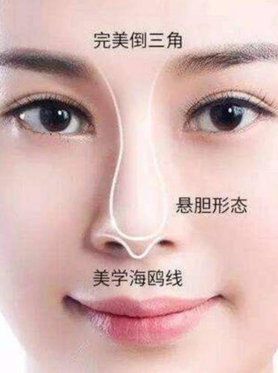 鼻子不好看,竟因没有"海鸥线"!
