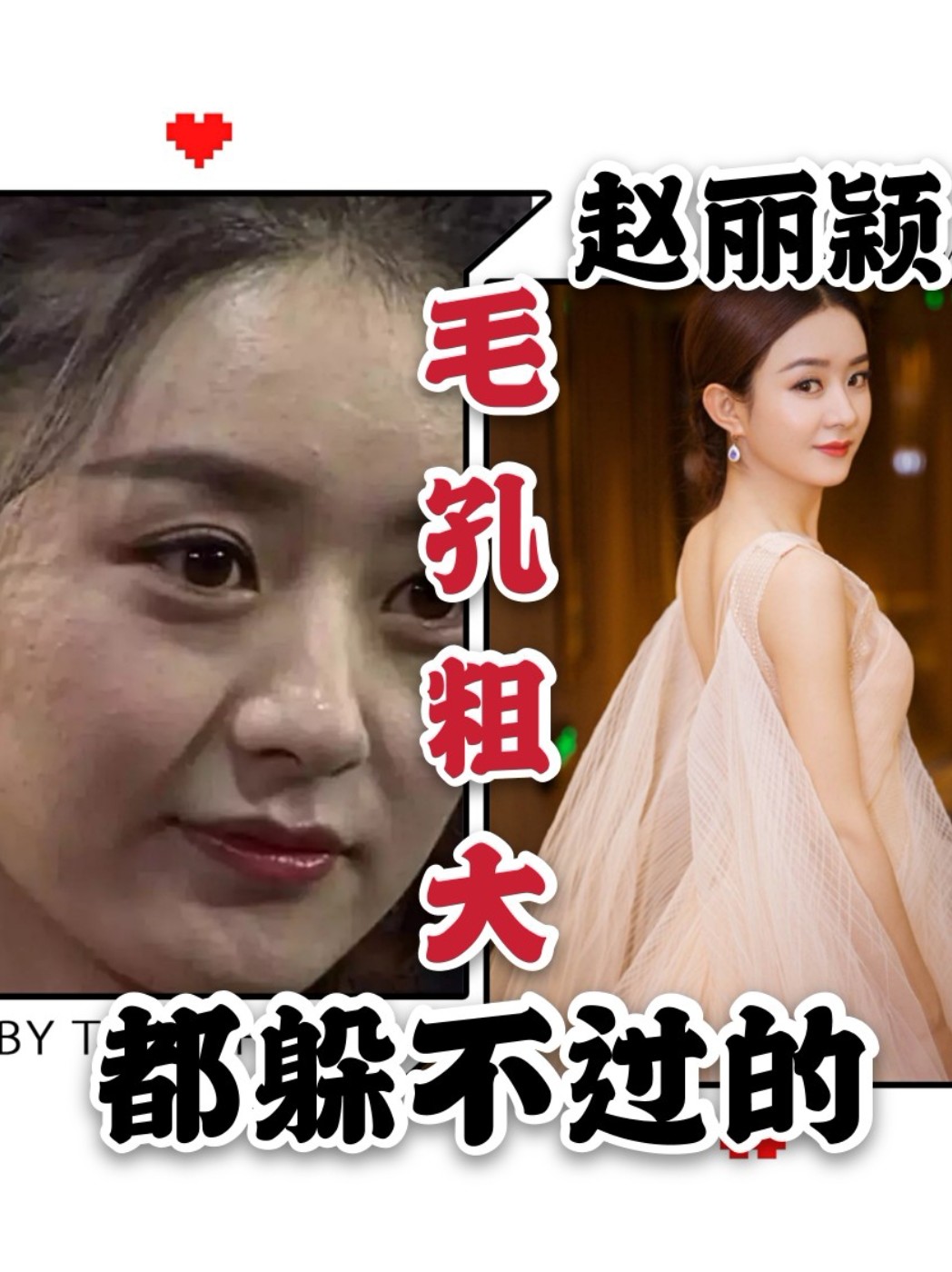 赵丽颖都躲不过的毛孔粗大
