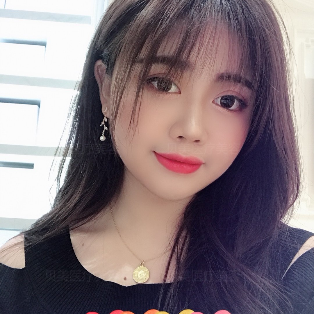 只看术前照片术你能猜出小姐姐竟然只有22岁6015让你_圈子-新氧