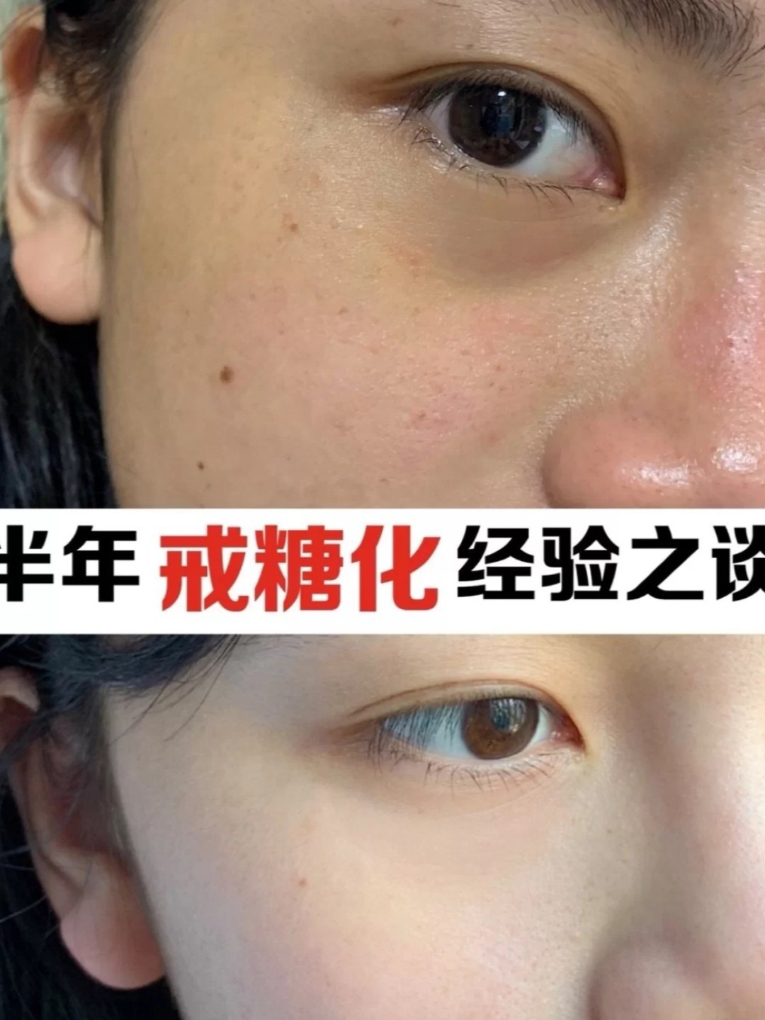 抗糖要趁早 教你正确抗糖 养出婴儿肌 对于现在这个 圈子 新氧美容整形