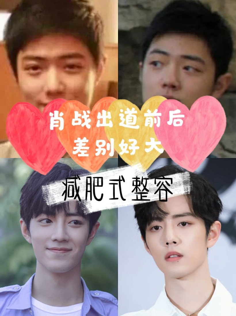92那个魏公子～肖战在出道_圈子-新氧美容整形