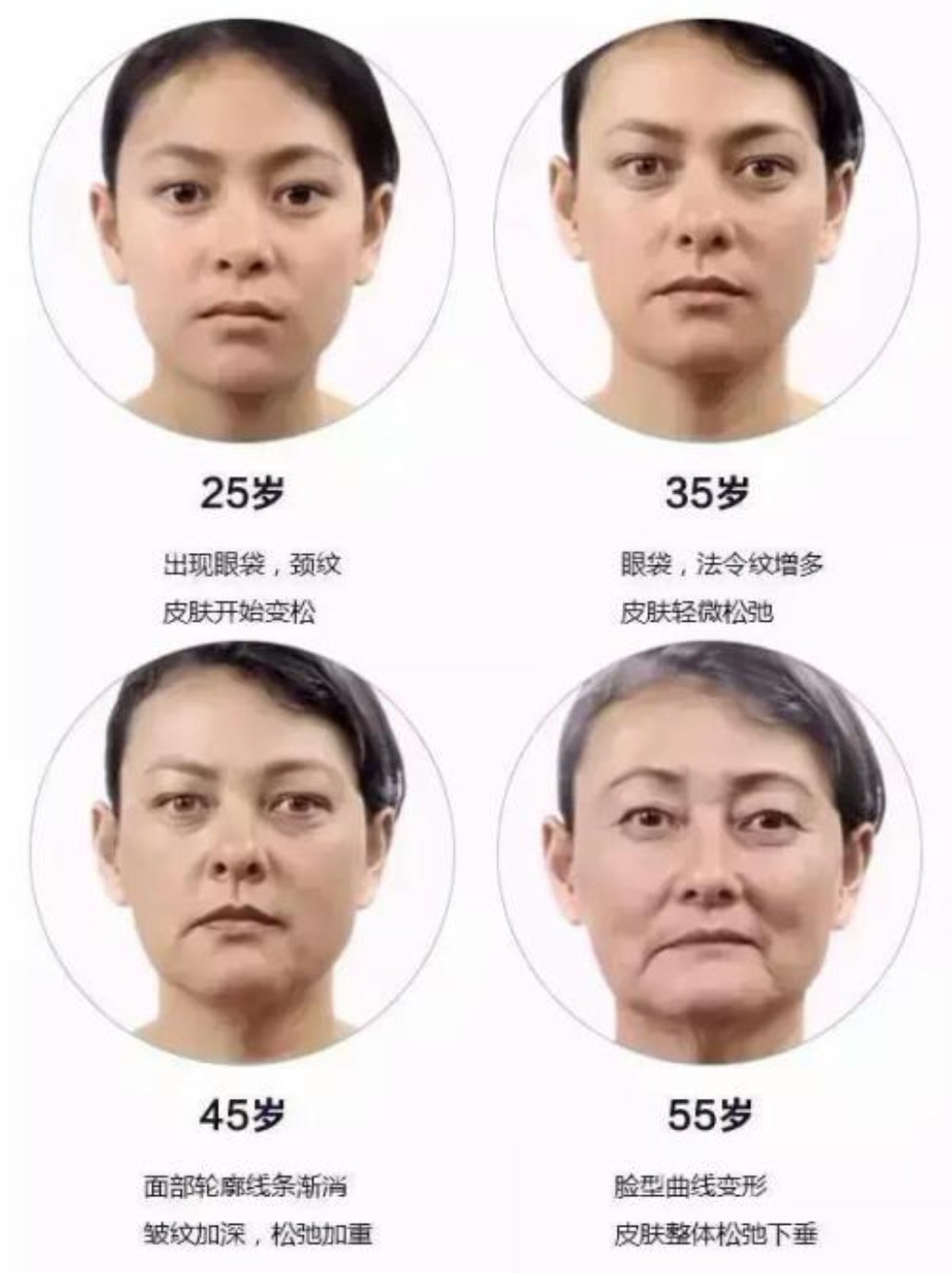 听说线雕分为大线小线有什么区别吗得咋选