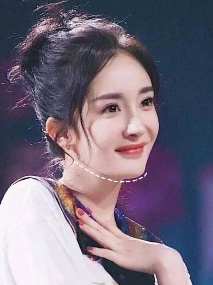 818杨幂的下颌变化_圈子-新氧美容整形