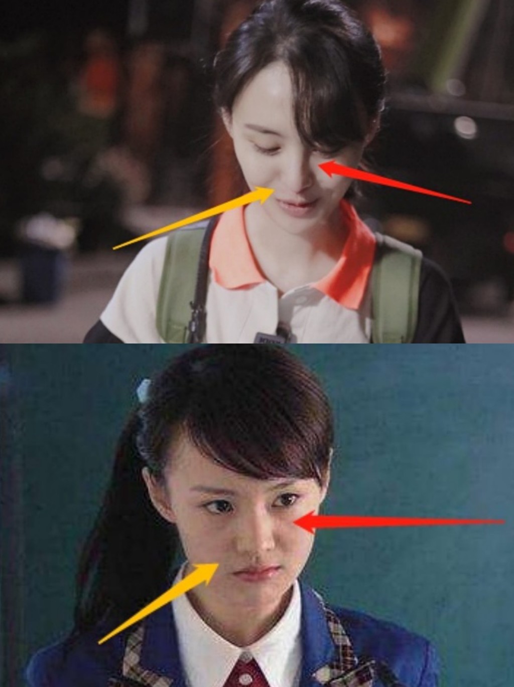 郑爽早期脸上满满胶原蛋白, 小圆脸,圆眼睛~ 整个人都充满了少女的