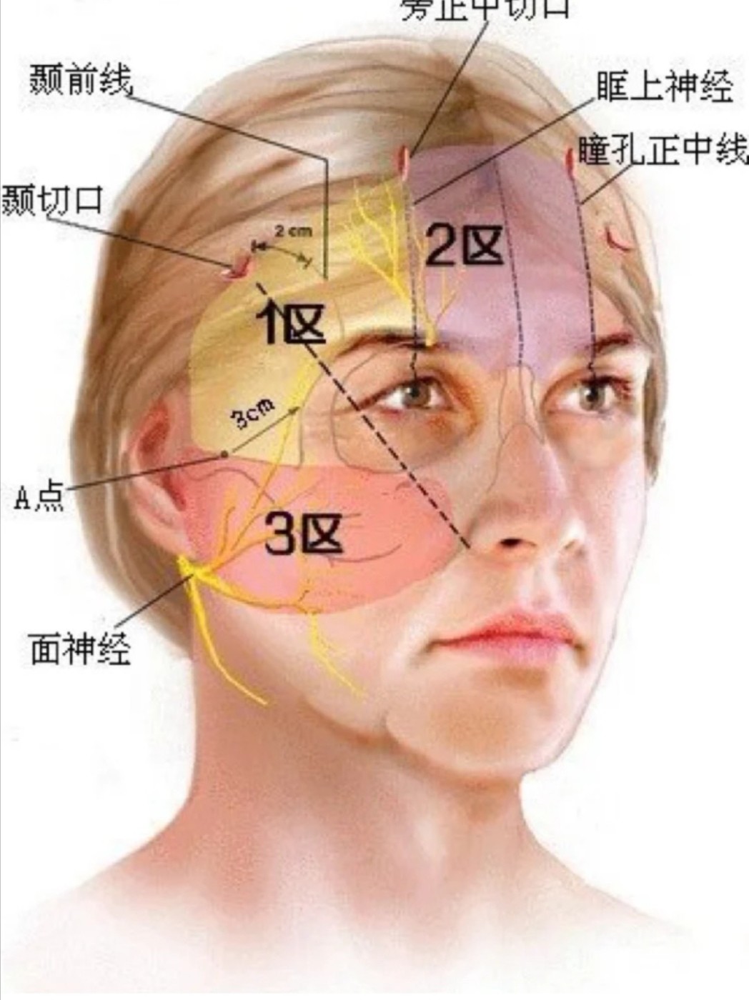 上庭过长不符合三庭五眼的标准,就会与理想的脸型产生差距,并且年纪