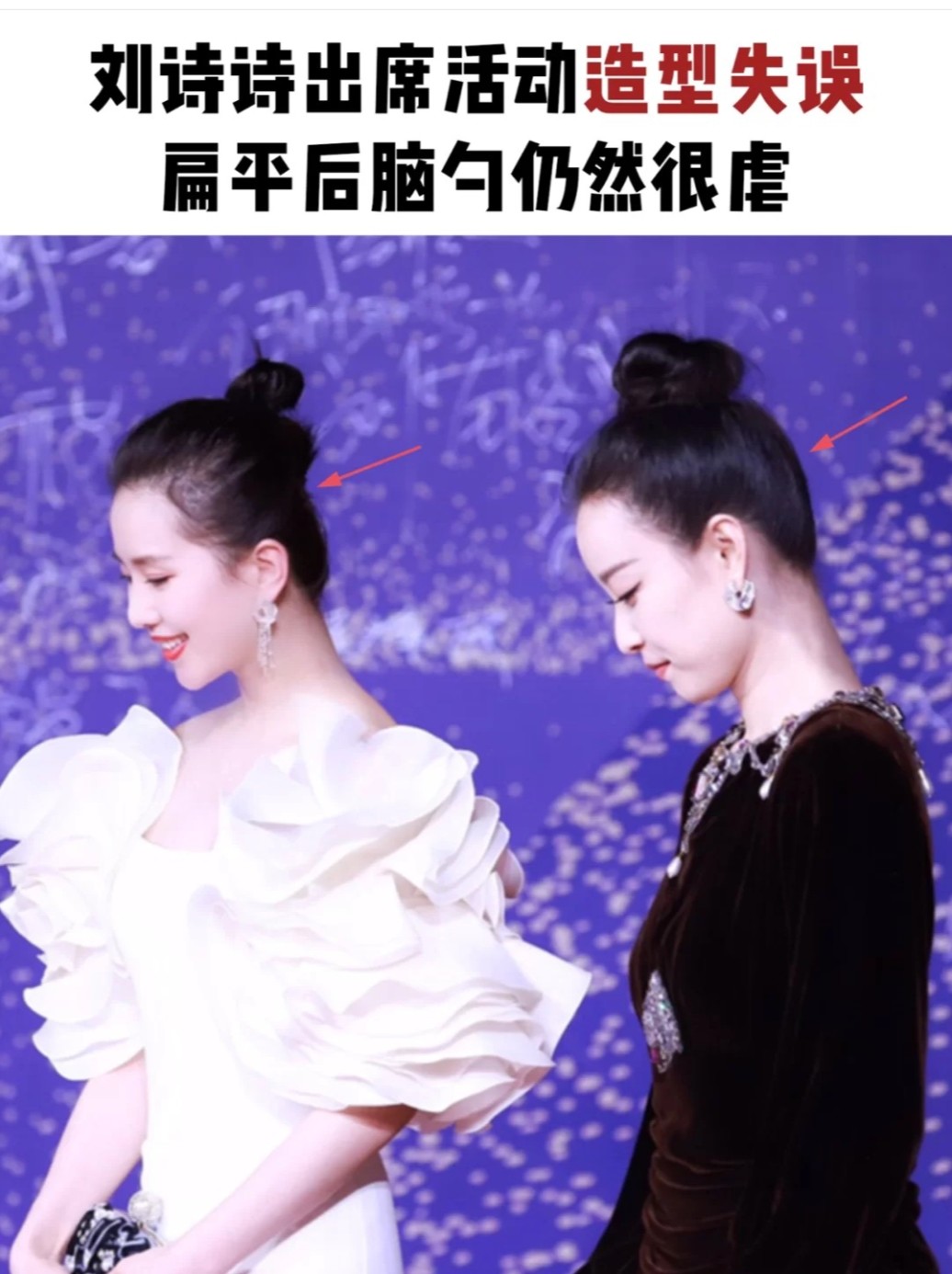 吉娜和刘亦菲的圆头羡慕了!扁头自救指南!