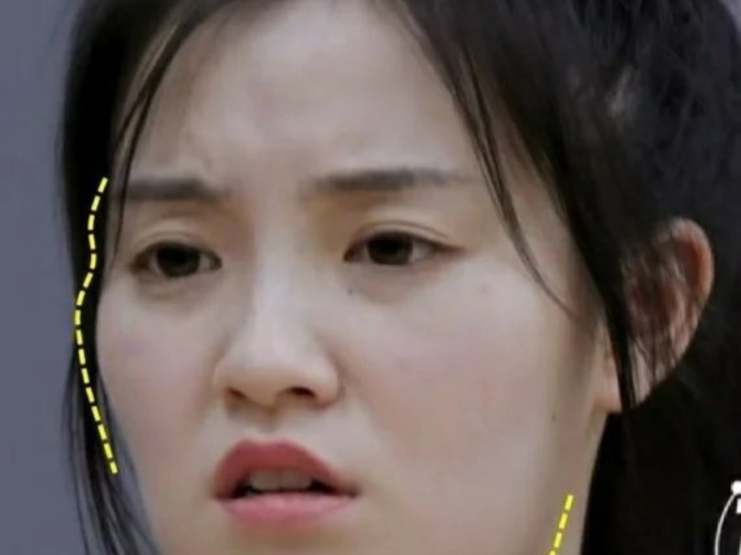 张楚寒这两年里应该是做了轮廓三件套?