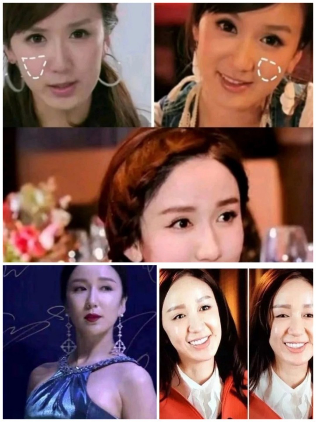 娄艺潇颜值一崩再崩哪里出了问题