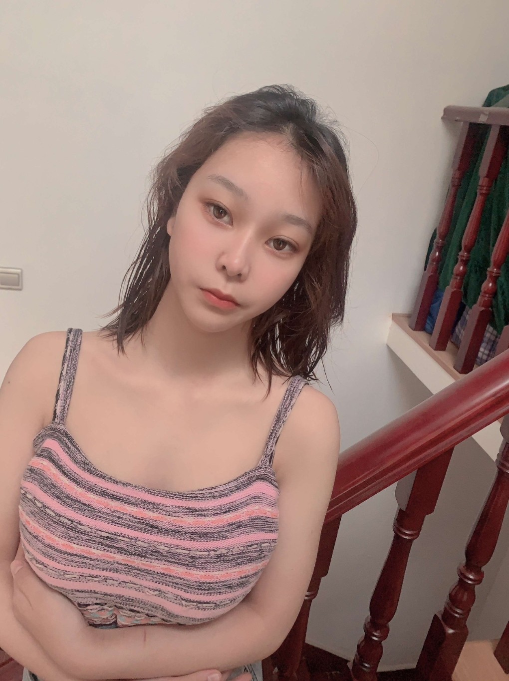 【自体脂肪丰胸术后246天】