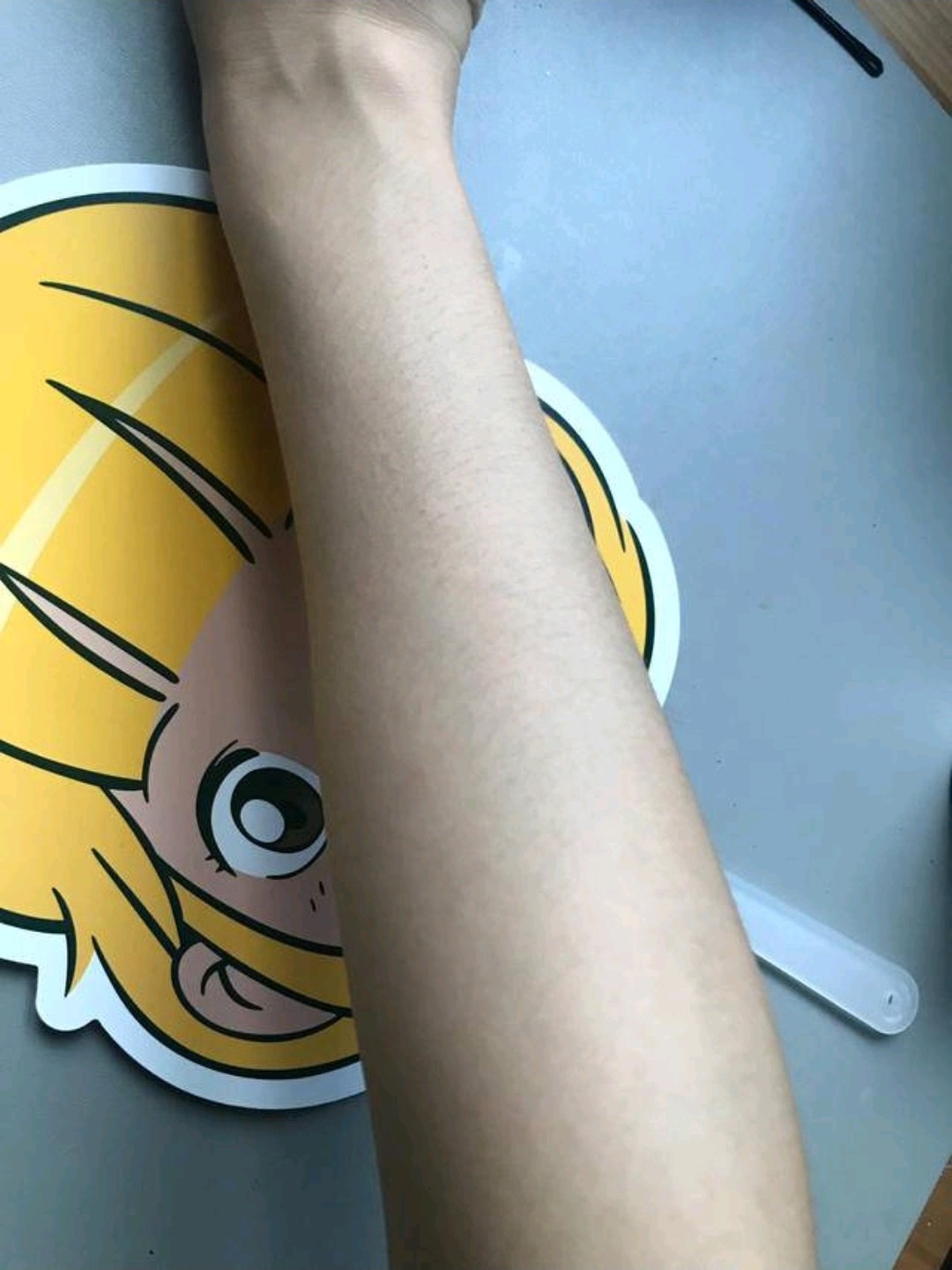 跟大家说说激光脱毛半年后的情况