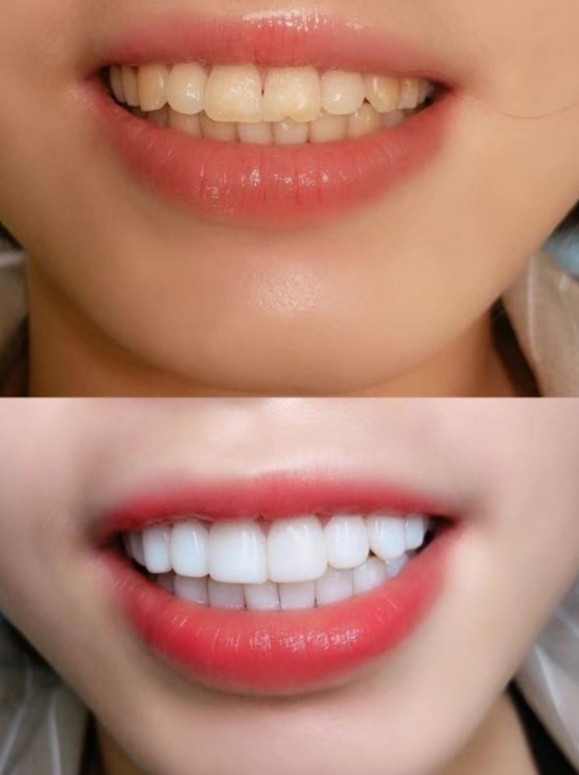 拥有一口大白牙!