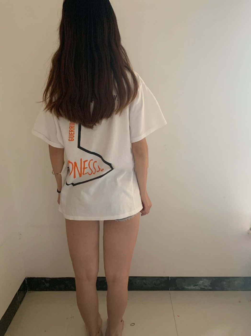 【沈阳汇美人大腿吸脂术前】90斤的脸,120斤的腿_圈子-新氧美容整形