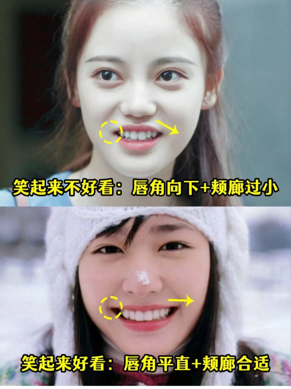 创造营孙珍妮颜值bug:人中过短&解决方案